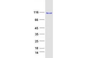 Validation with Western Blot