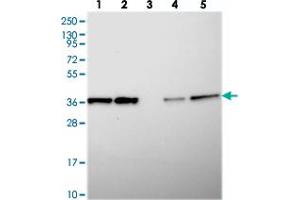Western blot analysis of Lane 1: RT-4, Lane 2: U-251 MG, Lane 3: Human Plasma, Lane 4: Liver, Lane 5: Tonsil with CHORDC1 polyclonal antibody  at 1:250-1:500 dilution. (CHORDC1 anticorps)