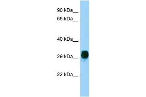 Host: Rabbit Target Name: FBXO17 Sample Type: HepG2 Whole Cell lysates Antibody Dilution: 1. (FBXO17 anticorps  (N-Term))