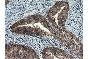 Image no. 2 for anti-Myeloid Leukemia Factor 1 (MLF1) antibody (ABIN1499496) (MLF1 anticorps)