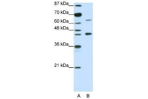 RARA antibody used at 1. (Retinoic Acid Receptor alpha anticorps  (N-Term))