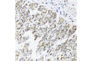Immunohistochemistry of paraffin-embedded mouse stomach using TIMM10B antibody at dilution of 1:100 (x40 lens). (TIMM10B anticorps)