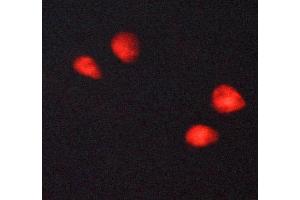 ABIN6269054 staining MCF-7 cells by ICC/IF.