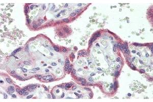 Detection of PLA2R1 in Human Placenta Tissue using Polyclonal Antibody to Phospholipase A2 Receptor 1 (PLA2R1) (PLA2R1 anticorps  (AA 1418-1487))