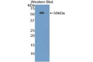 Detection of Recombinant Ntn1, Rat using Polyclonal Antibody to Netrin 1 (Ntn1) (Netrin 1 anticorps  (AA 313-565))