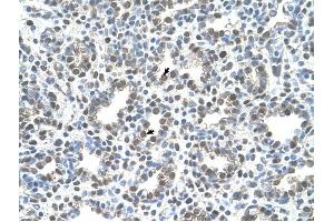 MCM3 antibody was used for immunohistochemistry at a concentration of 4-8 ug/ml to stain Alveolar cells (arrows) in Human Lung.