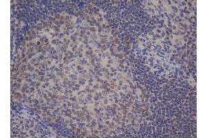 Image no. 1 for anti-B-Cell CLL/lymphoma 10 (BCL10) antibody (ABIN1496848) (BCL10 anticorps)