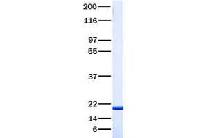 Validation with Western Blot (TNFRSF11A Protéine)