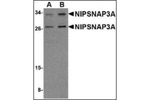 Western blot analysis of NIPSNAP3A in mouse brain tissue lysate with this product at (A) 0. (NIPSNAP3A anticorps  (Center))
