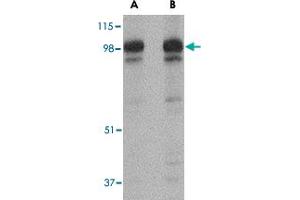 Western blot analysis of SLITRK2 in rat brain tissue lysate with SLITRK2 polyclonal antibody  at (A) 1 and (B) 2 ug/mL .