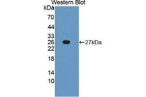 Detection of Recombinant TNFSF9, Mouse using Polyclonal Antibody to Tumor Necrosis Factor Ligand Superfamily, Member 9 (TNFSF9) (TNFSF9 anticorps  (AA 105-309))