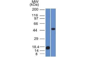 Western Blot of recombinant Adipophilin and Jurkat cell lysate using Adipophilin Mouse Monoclonal Antibody (ADFP/1365). (ADRP anticorps  (AA 249-376))