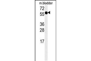 Western blot analysis in mouse bladder tissue lysates (15ug/lane). (ADSSL1 anticorps  (N-Term))