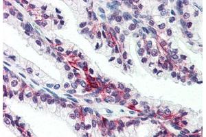 Anti-SLC39A6 antibody  ABIN1049338 IHC staining of human prostate. (SLC39A6 anticorps  (Internal Region))
