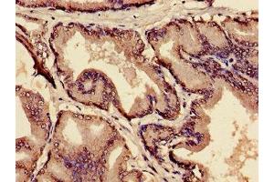 Immunohistochemistry of paraffin-embedded human prostate tissue using ABIN7159300 at dilution of 1:100 (MIA anticorps  (AA 87-124))