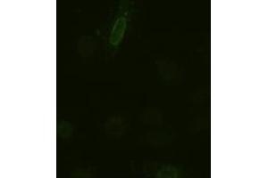 Anti-IL-6 mouse monoclonal antibody (ABIN2452353) immunofluorescent staining of HeLa cells transiently transfected by pCMV6-ENTRY IL-6 (RC202078) (IL-6 anticorps  (AA 29-212))