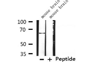 Western blot analysis of extracts from mouse brain, using K2C3 Antibody.
