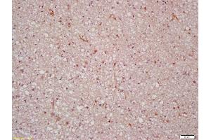 Formalin-fixed and paraffin embedded human brain labeled with Anti-n-Myc Polyclonal Antibody, Unconjugated (ABIN760676) at 1:200 followed by conjugation to the secondary antibody and DAB staining