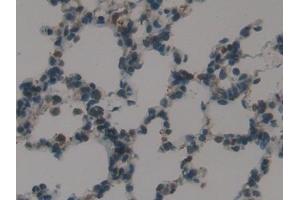 Detection of SP-B in Rat Lung Tissue using Polyclonal Antibody to Surfactant Protein B (SP-B)