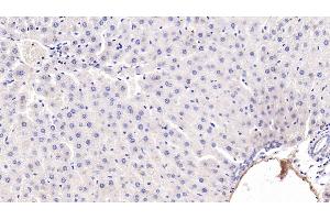 Detection of ADPN in Rat Liver Tissue using Monoclonal Antibody to Adiponectin (ADPN)