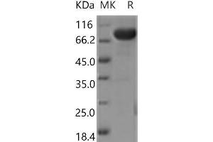 Western Blotting (WB) image for CD5 (CD5) protein (Fc Tag) (ABIN7321103) (CD5 Protein (CD5) (Fc Tag))