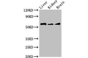 Western Blot Positive WB detected in: Mouse liver tissue, Mouse kidney tissue, Mouse brain tissue All lanes: CHRM5 antibody at 3. (CHRM5 anticorps  (AA 220-427))
