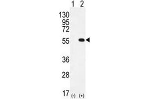 Western blot analysis of PRMT2 antibody and 293 cell lysate either nontransfected (Lane 1) or transiently transfected (2) with the PRMT2 gene. (PRMT2 anticorps  (AA 344-375))