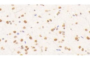 Detection of NUP88 in Mouse Cerebellum Tissue using Polyclonal Antibody to Nucleoporin 88 (NUP88) (NUP88 anticorps  (AA 57-296))