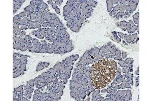 Expression of syntaxin 4 in rat pancreas - Immunohistochemical staining of rat pancreas paraffin embedded sections using Anti-Syntaxin 4 Antibody (ABIN7043796, ABIN7044650 and ABIN7044651), (1:100).