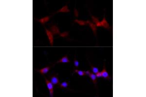 Immunofluorescence analysis of PC-12 cells using CYP1B1 antibody (ABIN3021930, ABIN3021931, ABIN3021932 and ABIN6217881) at dilution of 1:100 (40x lens).