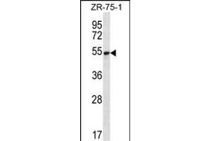 SEC62 Antibody (N-term) (ABIN656777 and ABIN2845996) western blot analysis in ZR-75-1 cell line lysates (35 μg/lane). (SEC62 anticorps  (N-Term))