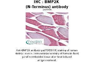 Image no. 2 for anti-BMP2 Inducible Kinase (BMP2K) (N-Term) antibody (ABIN1732361)
