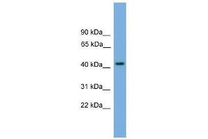 Western Blot showing PALM antibody used at a concentration of 1-2 ug/ml to detect its target protein. (Paralemmin anticorps  (N-Term))