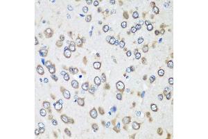 Immunohistochemistry of paraffin-embedded rat brain using EEF1G antibody.