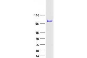 Validation with Western Blot