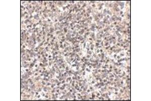 Immunohistochemistry of RSPO1 in human spleen tissue with this product at 2. (RSPO1 anticorps  (N-Term))