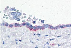 Human Ovary: Formalin-Fixed, Paraffin-Embedded (FFPE) (ENPP3 anticorps  (Internal Region))