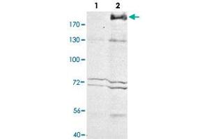 Western blot analysis of Mrc1 in whole cell extracts. (Macrophage Mannose Receptor 1 anticorps)
