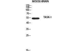 Western Blot (WB) analysis of Mouse Brain using TASK-1 antibody. (KCNK3 anticorps)