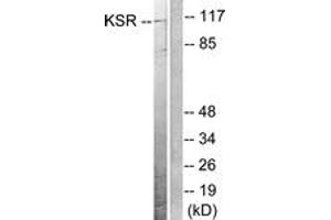 Western blot analysis of extracts from NIH-3T3 cells, treated with PDGF 50ng/ml 20', using KSR (Ab-392) Antibody. (KSR1 anticorps  (AA 358-407))