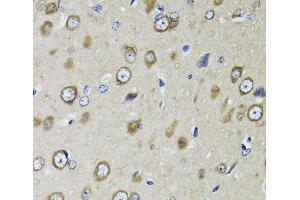Immunohistochemistry of paraffin-embedded Rat brain using RPS10 Polyclonal Antibody at dilution of 1:100 (40x lens). (RPS10 anticorps)