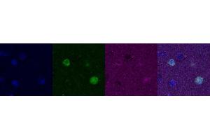 Immunohistochemistry (IHC) image for anti-Calbindin (CALB1) antibody (ABIN7456109)