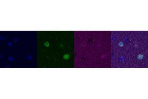 Immunohistochemistry (IHC) image for anti-Calbindin (CALB1) antibody (ABIN7456109) (CALB1 anticorps)