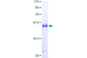 Image no. 1 for Small Proline-Rich Protein 3 (SPRR3) (AA 1-161) protein (GST tag) (ABIN1321255)