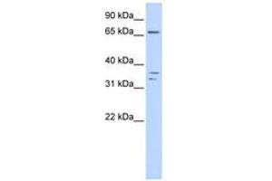 Image no. 1 for anti-IQ Motif Containing E (IQCE) (AA 288-337) antibody (ABIN6741340)
