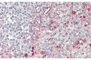 Detection of CD86 in Human Spleen Tissue using Polyclonal Antibody to Cluster Of Differentiation 86 (CD86)