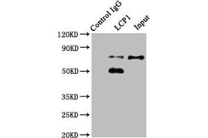 Immunoprecipitating LCP1 in Jurkat whole cell lysate Lane 1: Rabbit control IgG instead of ABIN7163556 in Jurkat whole cell lysate. (LCP1 anticorps  (AA 2-627))