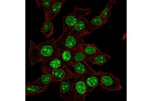 Confocal Immunofluorescence of HeLa cells Ki67 Mouse Monoclonal Antibody (MKI67/2465). (Ki-67 anticorps  (AA 2293-2478))