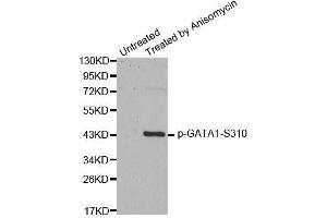 Western blot analysis of extracts from HT29 cells, using Phospho-GATA1-S310 antibody (ABIN2988025). (GATA1 anticorps  (pSer310))