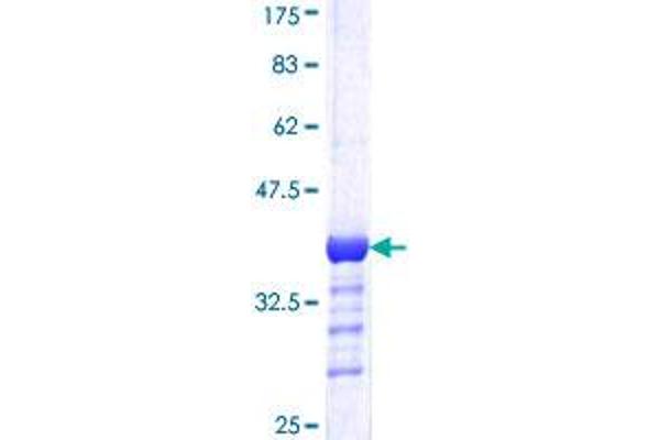 DDB1 Protein (AA 1044-1140) (GST tag)